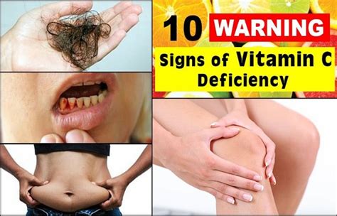 10 Common Symptoms of Vitamin C Deficiency! - Fastnewsfeed