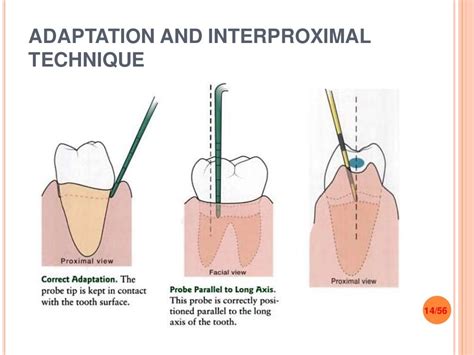 Periodontal instruments