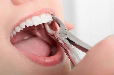 Removing the sick tooth from girls mouth - Midwest Dental Center Blog