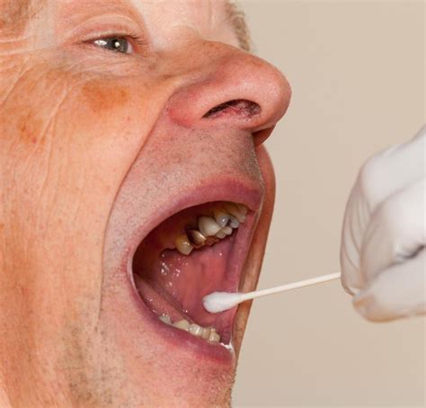 What Is an Oral Swab? (with pictures)