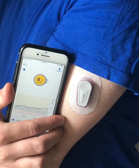 CGM Devices for Non-Diabetics: Hype or Help?