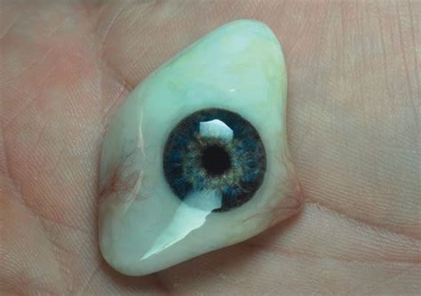 A scleral shell eye conformer type of prosthesis | Prosthetics, Parts of the eye, Ocular prosthesis