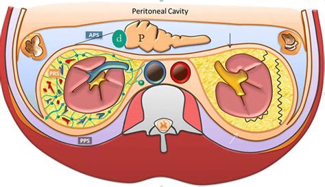 Acute conditions affecting the perinephric space: imaging anatomy, pathways of disease spread ...