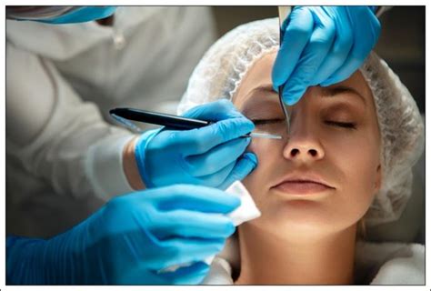 Financiación Cirugia Facial - Cirucredito