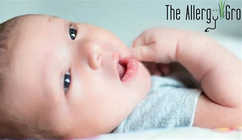 Babies & Food Allergies - Asthma & Allergy Clinic | Boise, Nampa, Eagle ...