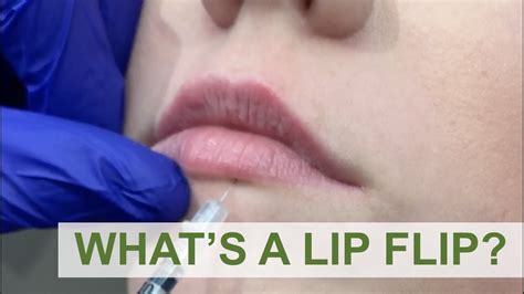 What's a lip flip?! - YouTube