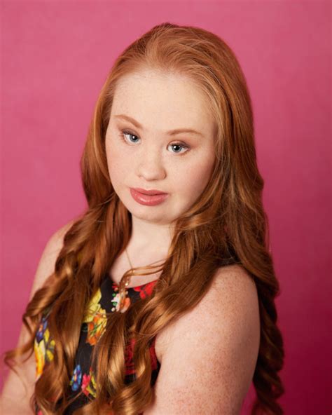 Aspiring Teen Model with Down Syndrome Determined to Redefine Beauty ...