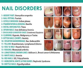 Fingernail ridges thyroid - Awesome Nail