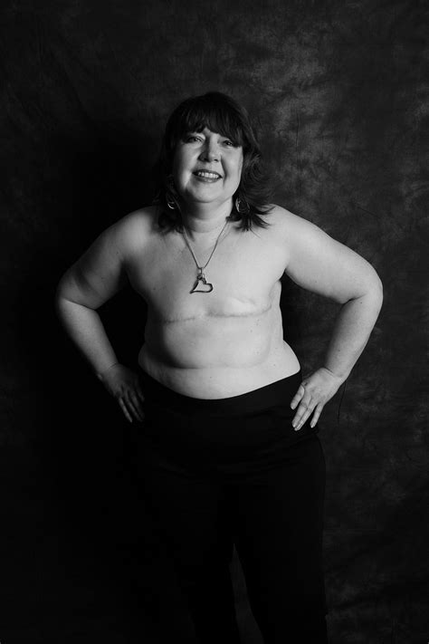 Women Bare Mastectomy Scars In Empowering Photos To Raise Breast Cancer ...