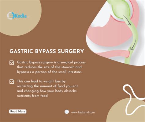 Gastric Bypass Surgery and its Cons and Alternative ESG - Dallas, TX