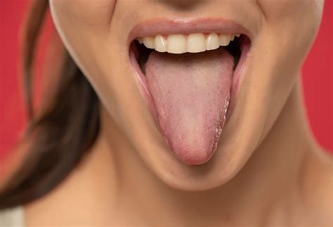 What Does A Healthy Tongue Look Like? | The Well by Northwell