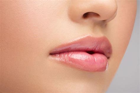 Juvederm Voluma for Enhancing Lips - Health Supplies Plus