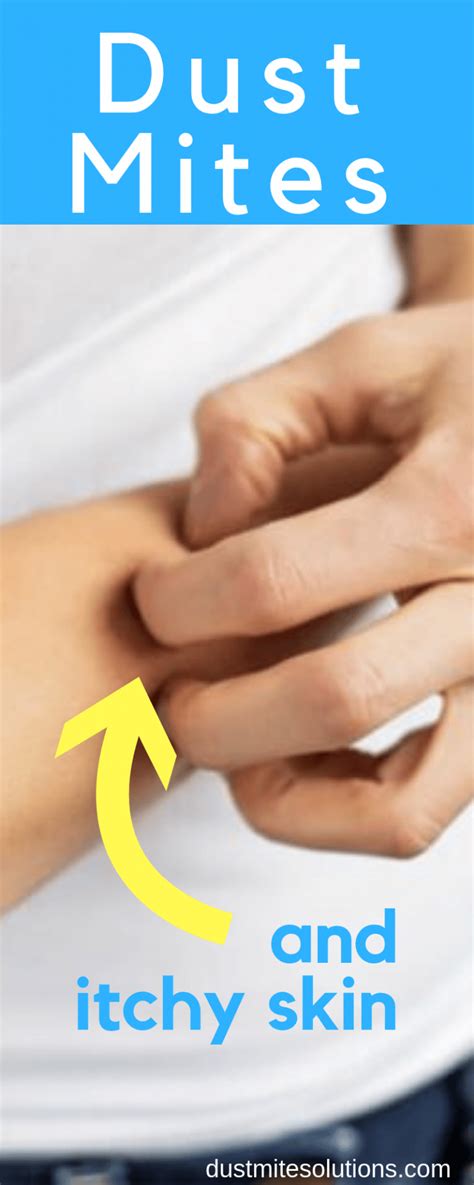 Dust Mite Allergy Symptoms: Itchy Skin | How I Manage My Allergy