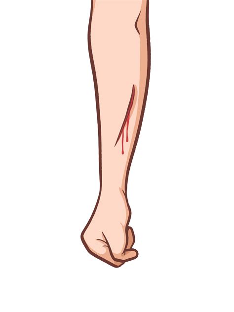 Bleeding scar or wound on arm hand skin vector illustration isolated on vertical white ...