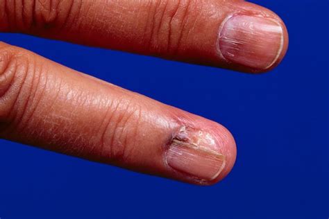 What Your Nails Can Tell You About Your Health | HuffPost Life