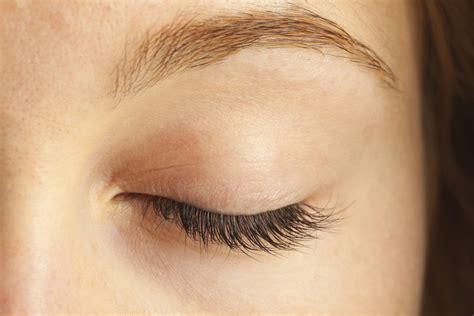 How to Clean the Eyelids after Eyelid Surgery - Little Rock, AR