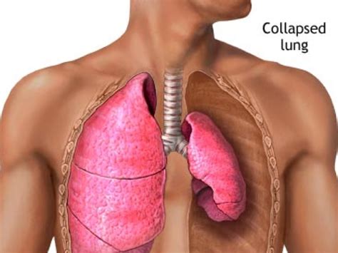 Pulmonology: Diseases And Conditions by Baanie D.