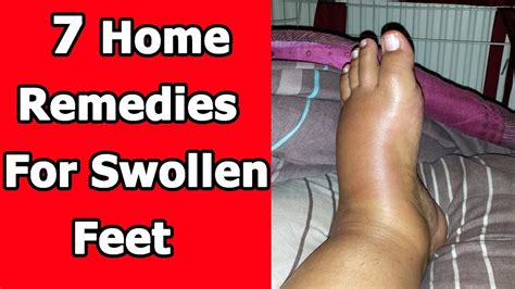 7 Home Remedies For Swollen Feet That Work - YouTube