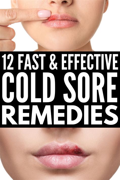 Natural Cold Sore Remedy, Healing Cold Sore, Natural Cures, Diy Cold ...