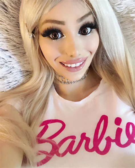 Woman 'too hot to work' after $135k Barbie plastic surgery