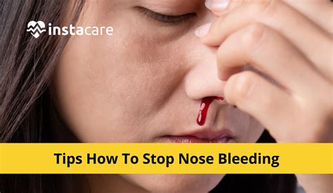7 Tips How To Stop Nose Bleeding