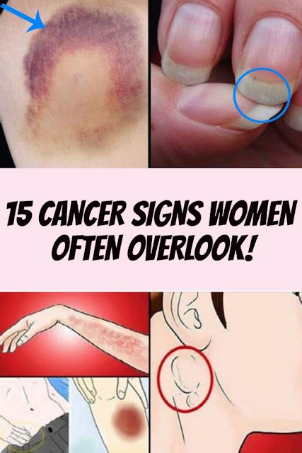 15 Cancer Signs Women Often Overlook!