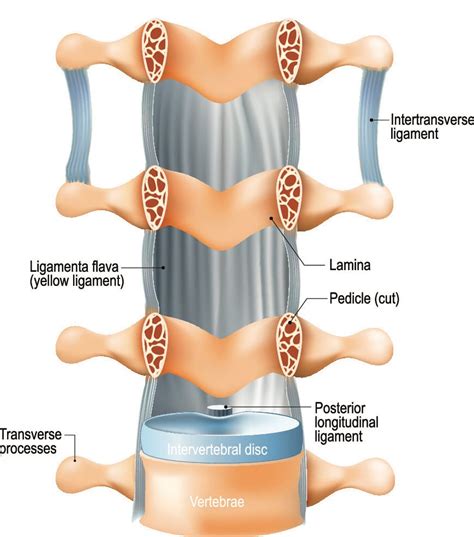 Ligamentum Flavum Hypertrophy: Definition, Causes, Symptoms, and ...