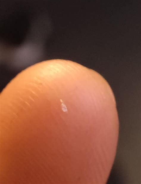 Are these lice eggs? : r/Lice