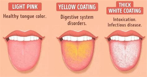 What does it mean when your tongue is… - Dental Supplies Buying Guide ...