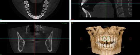 Cone Beam 3D Imaging | GT Dental Centre: Cosmetic and Family Dentist in ...