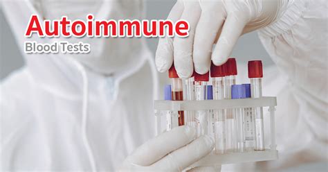 Autoimmune Blood Tests: Various types of it that you must be aware of! - Dr. Orawan