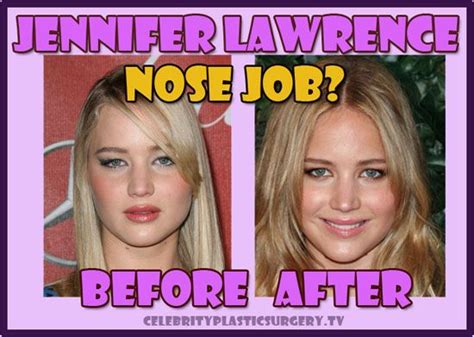 Jennifer Lawrence Plastic Surgery Nose Job Before And After | Jennifer ...