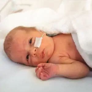 A Weekly Look at Premature Babies: Complications and Care - Nightingale ...