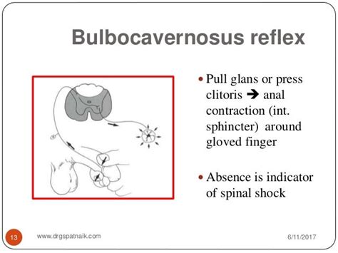 Spinal injuries