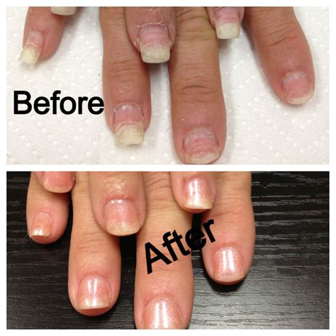 Damaged Nails After Extensions: Causes And Treatment