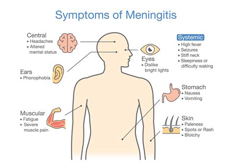 Learn about meningitis from Dr Christina | Meningitis, Bacterial meningitis, Viral meningitis