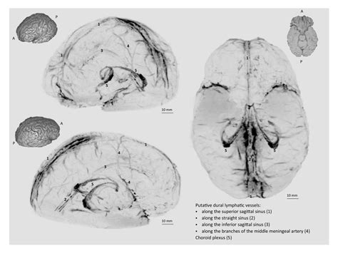 Surprise! Scientists Discover the Human Brain Has a Lymphatic System. - Big Think