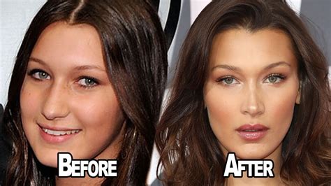 Bella Hadid Before After