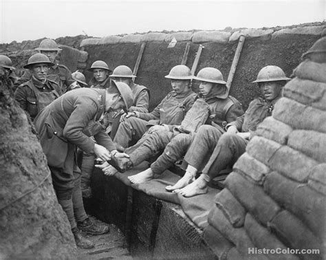 Trench Foot Inspection WW1 – Colorized Historical Pictures