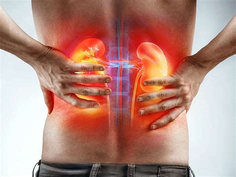 Kidney Problems: 10 Symptoms of Kidney Problems