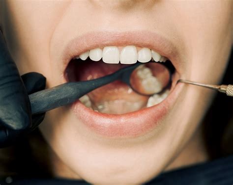 Actions That Weaken Your Teeth and Gums | RosyCheeked
