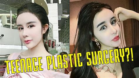 15-Year-Old Gets Extreme Plastic Surgery: Cosmetic Surgery in Asia ...