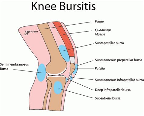 The most common knee injuries and disorders - kneesafe.com