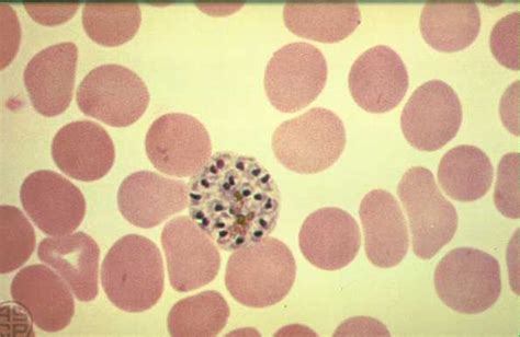 Plasmodium vivax