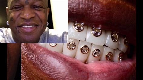 Lil Wayne Teeth Diamonds - 5 Stars With Gold Teeth Grills Or Encrusted ...