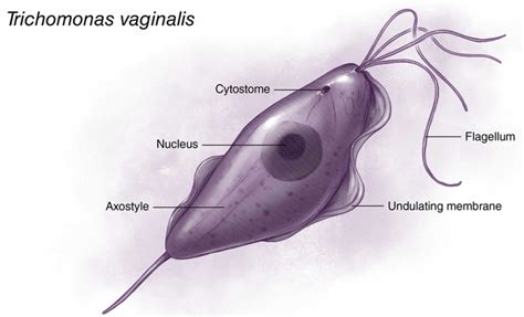 Trichomoniasis causes, symptoms in men & women, diagnosis & treatment