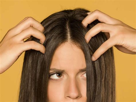 "Scalp Build-Up: Causes, Symptoms, and Treatment for Healthy Hair ...