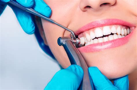 #HealthFeature: Six Benefits of Getting a Dental Cleaning - CNW Network