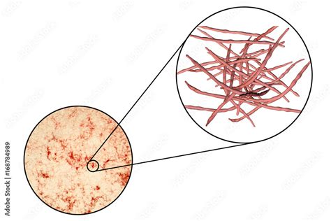 Actinomycetes, gram-positive anaerobic bacteria which resemble fungi ...