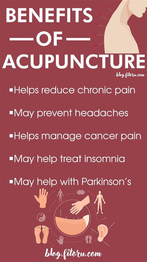 Pin on Acupuncture Benefits